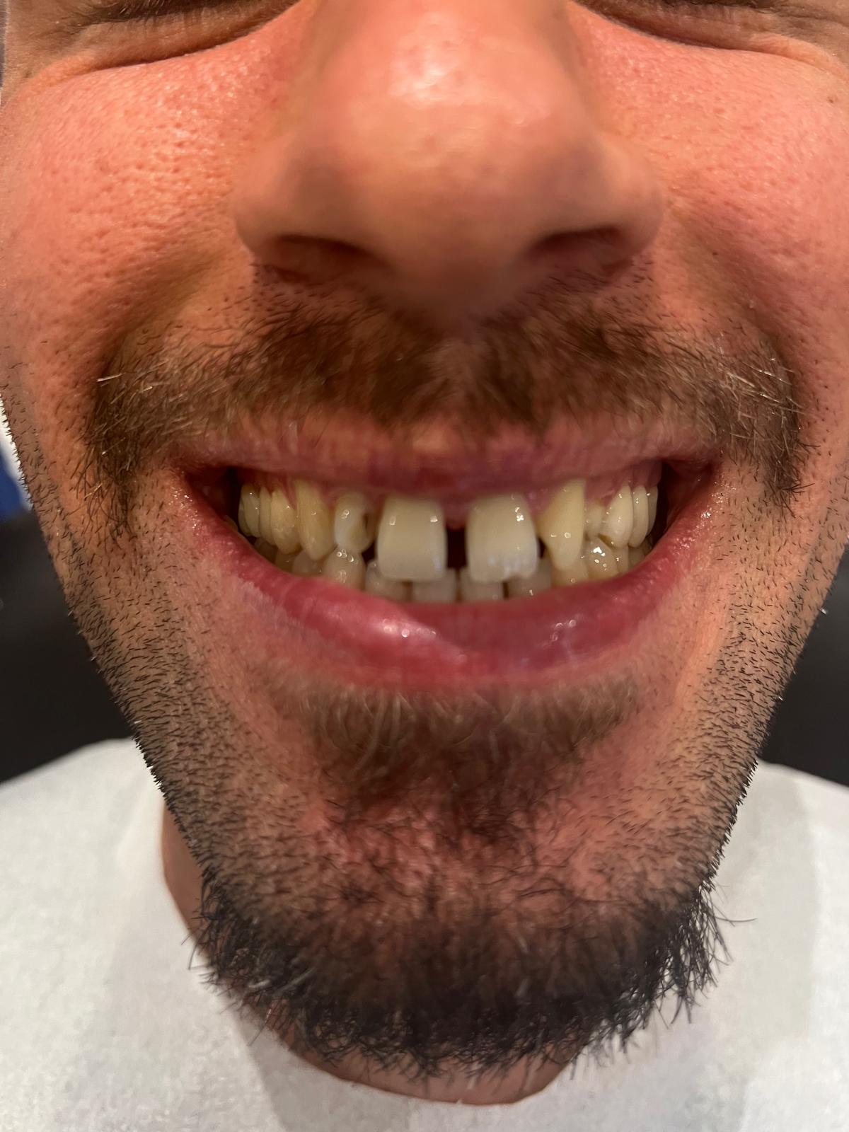 ECE Dental Patient Transformation